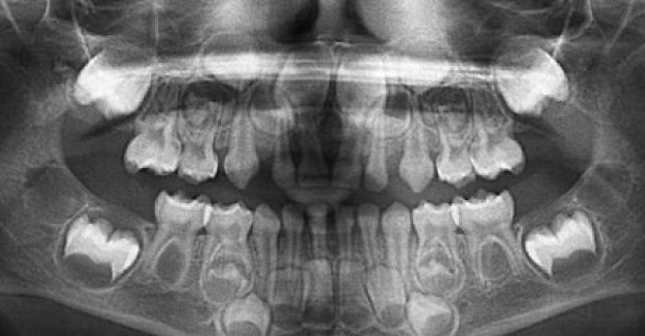 Radiografías Extraorales