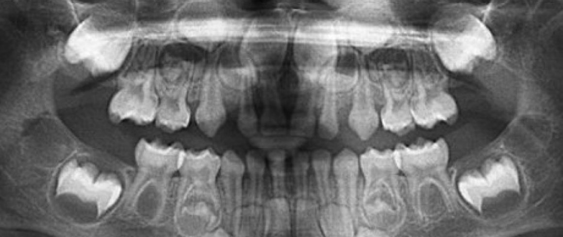 Radiografías Extraorales